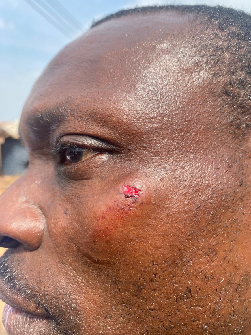 ELECTION 2024: Violence Erupts on Election Day in Ayomso: NPP Officer Allegedly Attacked by NDC Thugs