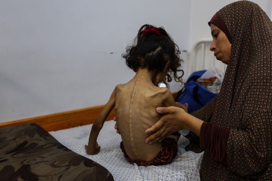 Famine Declared in Gaza as Over Half a Million Face Starvation